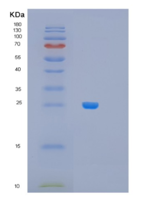 Recombinant Human MRPL28 Protein