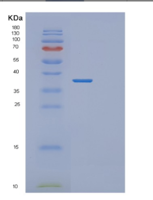 Recombinant Human MSI2 Protein