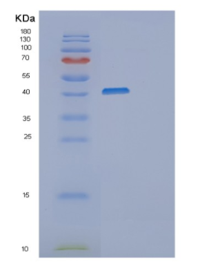 Recombinant Human MSR1 Protein