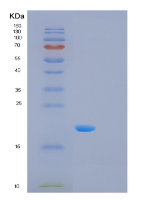 Recombinant Human MSRB2 Protein