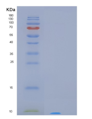 Recombinant Human MT3 Protein