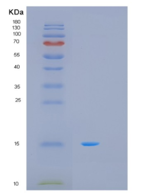 Recombinant Human MTCP1 Protein