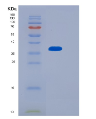 Recombinant Human MTHFD2 Protein