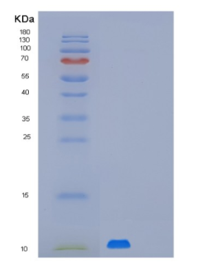 Recombinant Human MUSTN1 Protein