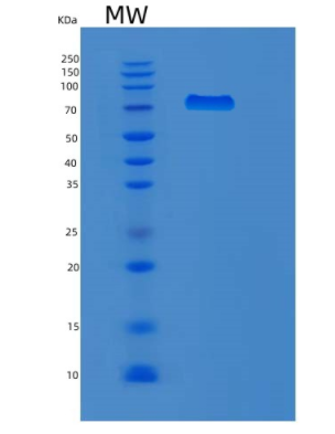 Recombinant Human MX1 Protein