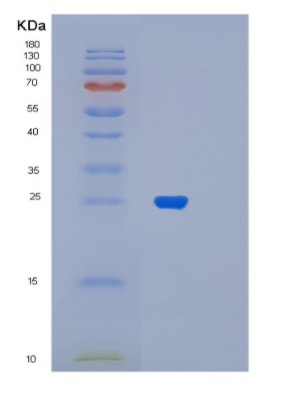 Recombinant Human MYL6B Protein