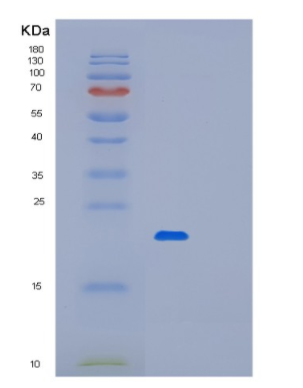 Recombinant Human MYL7 Protein