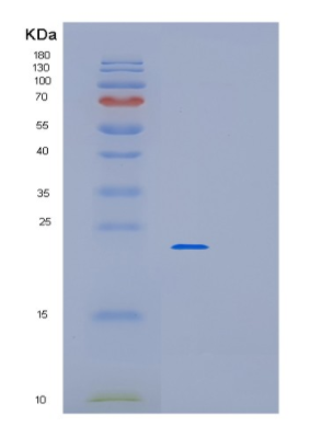 Recombinant Human MYL9 Protein