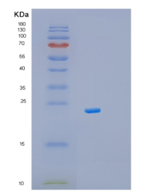 Recombinant Mouse Myl9 Protein