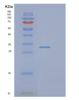 Recombinant Human NAA10 Protein