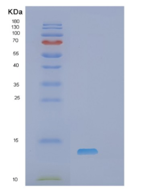 Recombinant Human MYOZ1 Protein