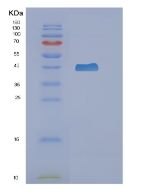 Recombinant Human NAPSA Protein