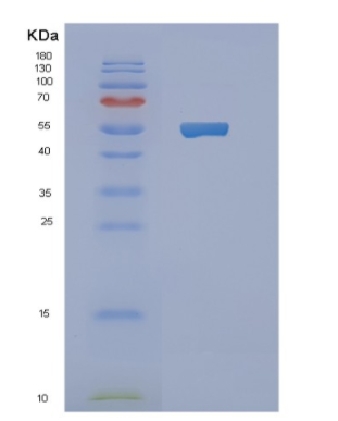 Recombinant Human NBC1 Protein