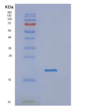 Recombinant Human NCBP2 Protein