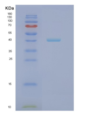 Recombinant Human NCF4 Protein