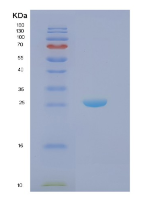 Recombinant Human NCR Protein