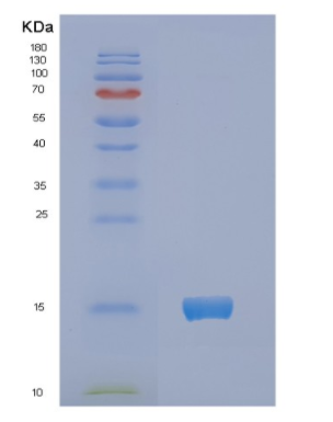 Recombinant Human NCR3 Protein