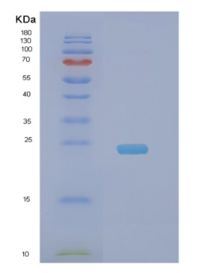 Recombinant Human NDUFB9 Protein