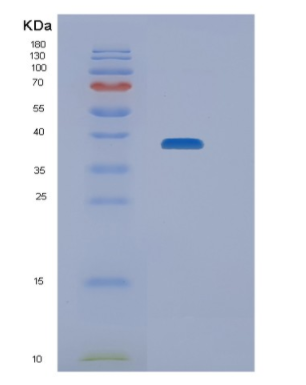 Recombinant Human NEIL2 Protein