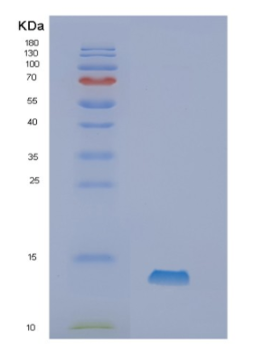 Recombinant Human Neurokinin B Protein