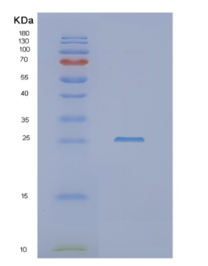 Recombinant Human NHEJ1 Protein