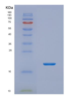 Recombinant Human NHP2 Protein