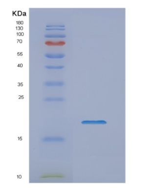 Recombinant Human NME1 Protein