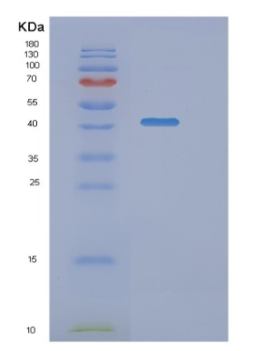 Recombinant Human NANS Protein