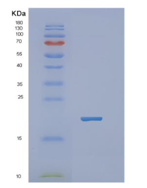 Recombinant Human NBL1 Protein