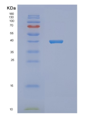 Recombinant Human NDE1 Protein