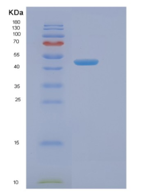 Recombinant Human NAGA Protein