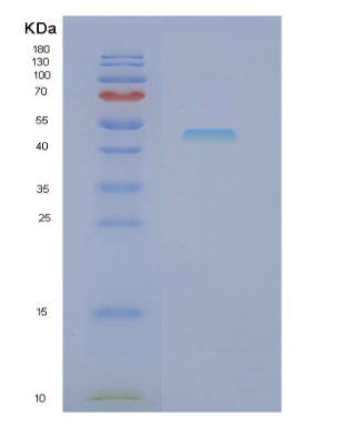 Recombinant Human NCK1 Protein