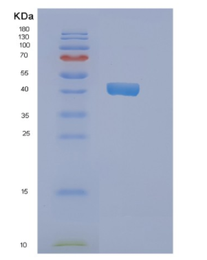 Recombinant Human NDRG2 Protein