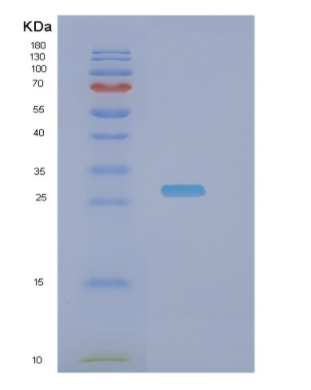 Recombinant Human NDUFS3 Protein