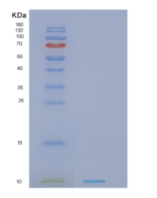 Recombinant Human NDUFV3 Protein
