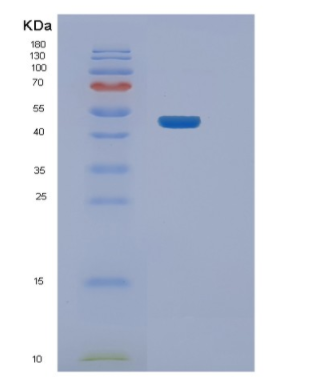 Recombinant Human NEIL1 Protein