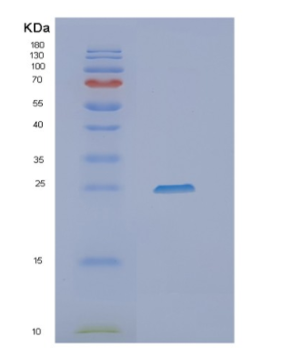 Recombinant Human NEUROG3 Protein