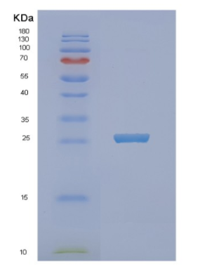 Recombinant E.coli NFNB Protein