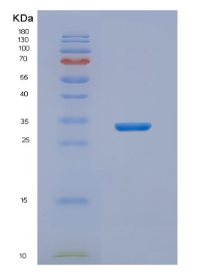 Recombinant Human NIT2 Protein