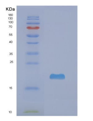 Recombinant Human NME3 Protein