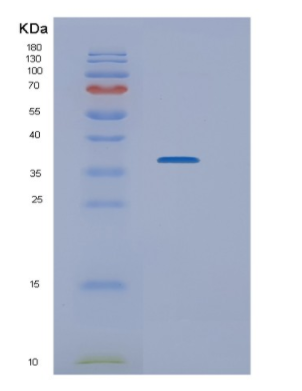 Recombinant Human NEK7 Protein