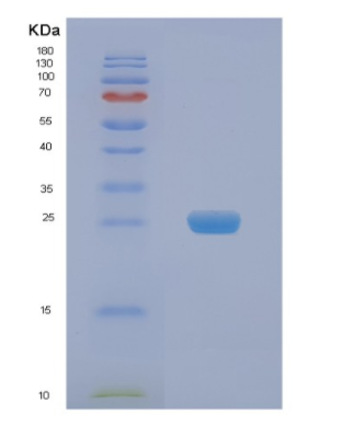 Recombinant Human NAA50 Protein