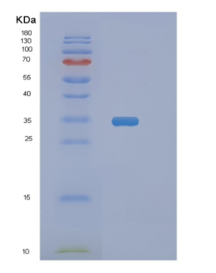 Recombinant Human NANOGP8 Protein