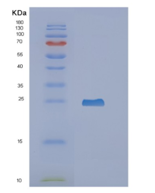 Recombinant Human NCALD Protein