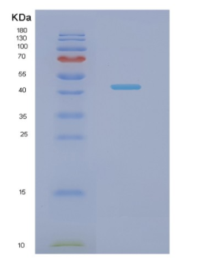 Recombinant Human NDUFS2 Protein