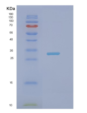 Recombinant Human NECAP2 Protein