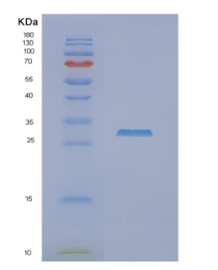 Recombinant Human NFU1 Protein