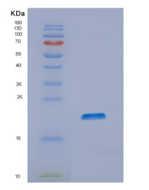 Recombinant Human NIP7 Protein