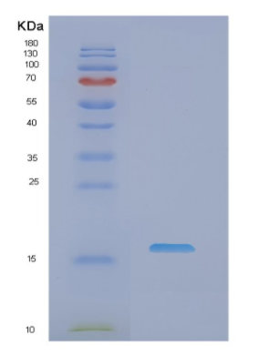 Recombinant Human NME2 Protein