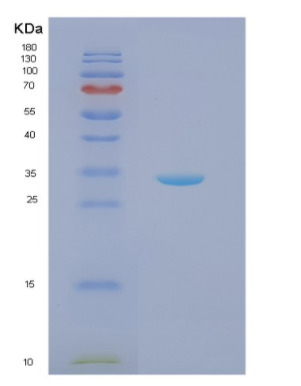 Recombinant Human NQO1 Protein